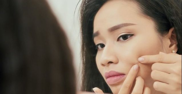 Cara Menghilangkan Bekas Jerawat Akibat Dipencet